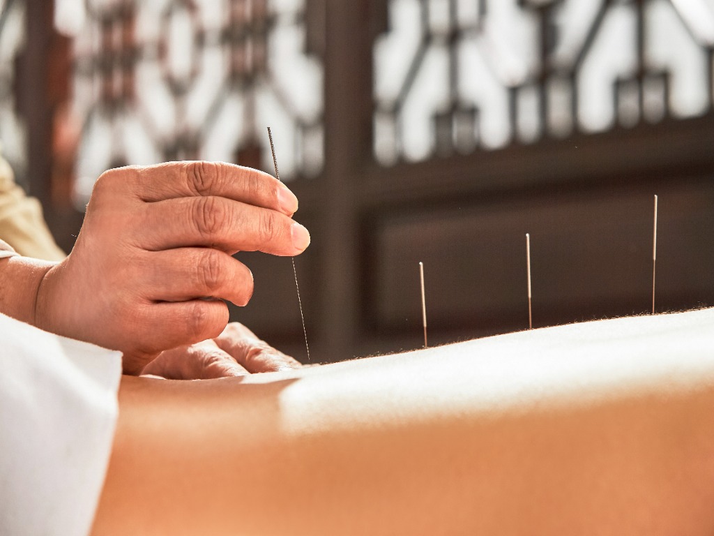 acupuncture bienfaits