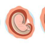 Les Trois Premiers Mois de la Grossesse : Ce Qu’il Faut Absolument Éviter