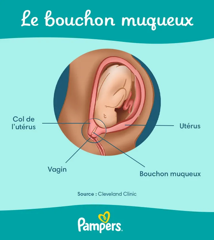 Perte du bouchon muqueux : Que faire ?