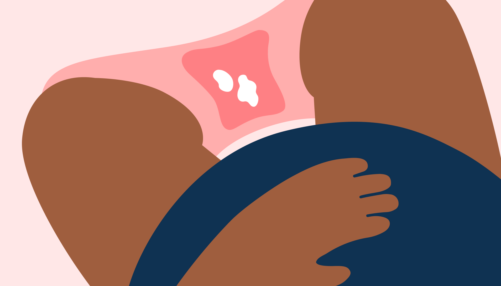 Comment sont les pertes blanches en début de grossesse