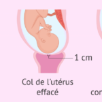 Quels aliments favorisent l&rsquo;ouverture du col de l&rsquo;utérus ?