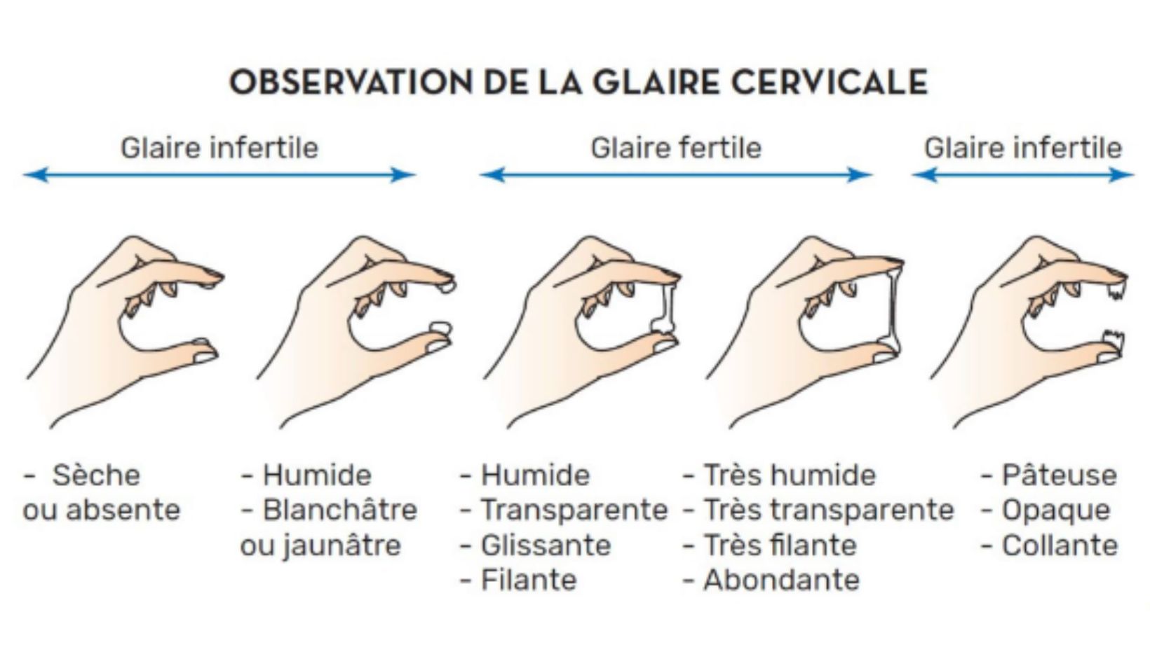 aspect glaire cervicale