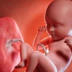 Le décollement du placenta et ses risques