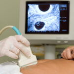 Peut-on avoir une grossesse normale avec un fibrome ou un myome