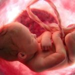 Placenta calcifié : Causes et conséquences pour le bébé