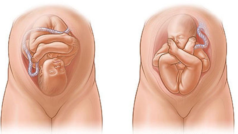 À quel moment bébé se retourne dans l’utérus ?