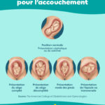 Bébé en position siège, comment l&rsquo;aider bébé à se retourner  ?