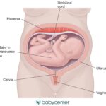 Pourquoi mon bébé est en transverse ?