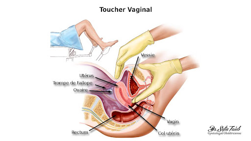 Toucher vaginal : Tout savoir sur cet examen gynécologique