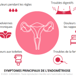 Endométriose : comprendre les symptômes et trouver des solutions